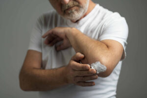 psoriase-como-aparece-e-como-tratar-dermatologista